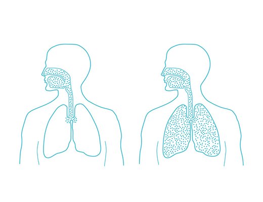 Microsalt droogzoutinhalatie